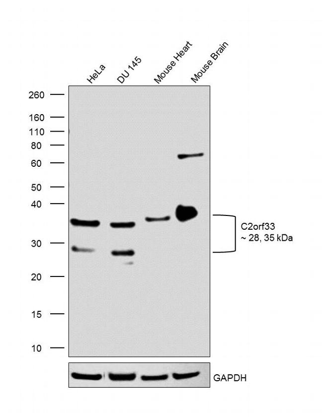 C2orf33 Antibody in Western Blot (WB)