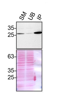 VAPB Antibody in Immunoprecipitation (IP)