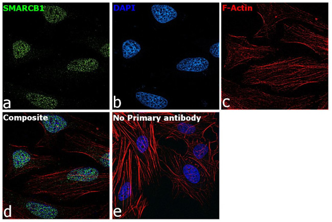 SMARCB1 Antibody in Immunocytochemistry (ICC/IF)