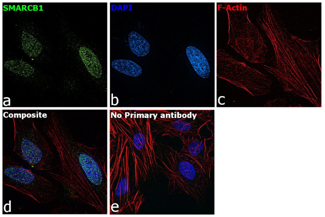 SMARCB1 Antibody in Immunocytochemistry (ICC/IF)