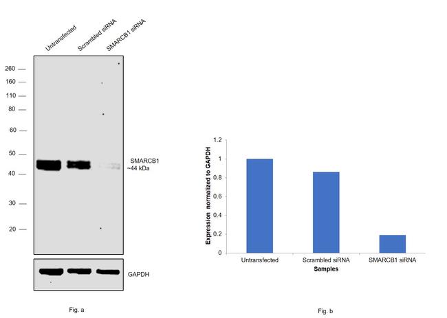 SMARCB1 Antibody in Western Blot (WB)