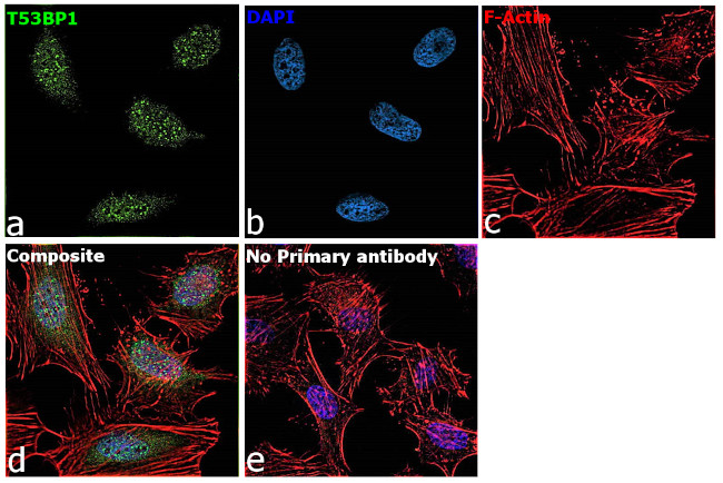 53BP1 Antibody in Immunocytochemistry (ICC/IF)