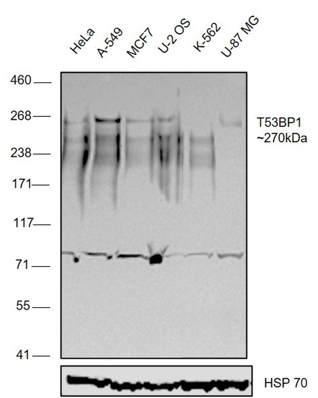 53BP1 Antibody in Western Blot (WB)