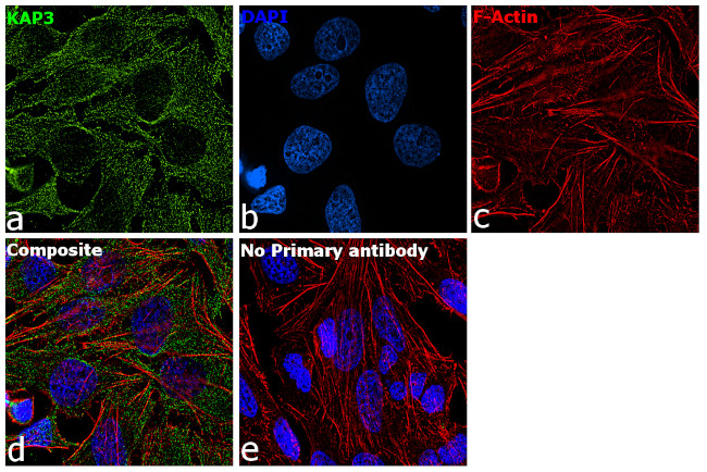 KAP3 Antibody in Immunocytochemistry (ICC/IF)