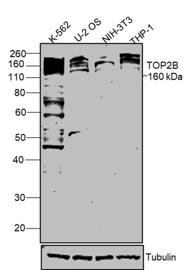 TOP2B Antibody in Western Blot (WB)