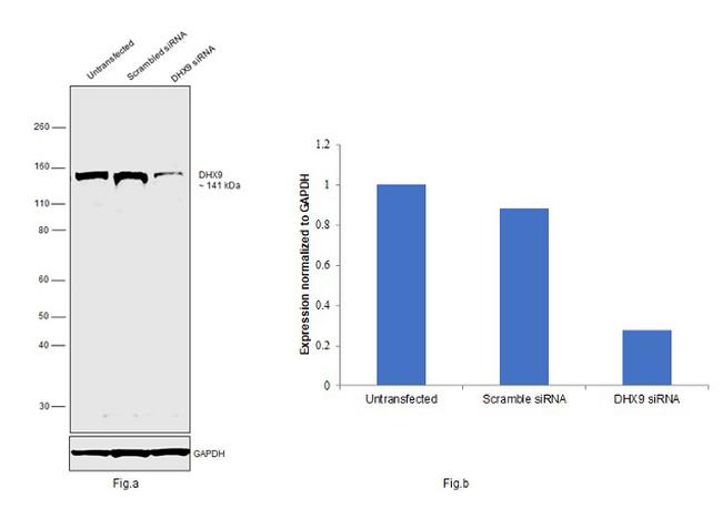 DHX9 Antibody in Western Blot (WB)