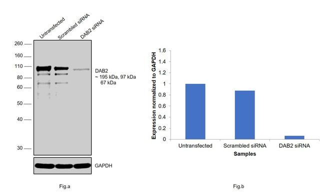 DAB2 Antibody in Western Blot (WB)