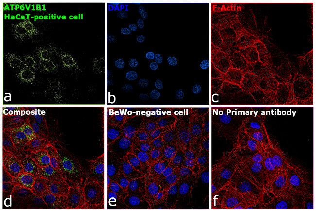 ATP6V1B1 Antibody