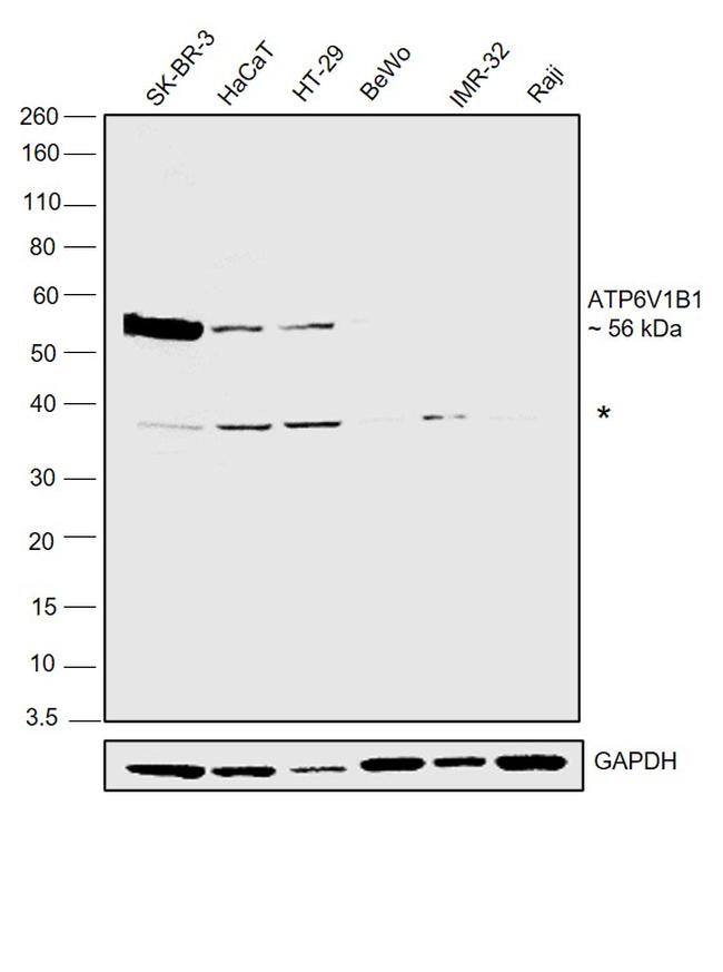 ATP6V1B1 Antibody in Western Blot (WB)