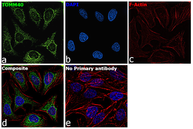 TOMM40 Antibody in Immunocytochemistry (ICC/IF)