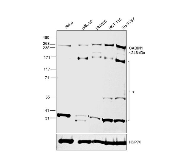 CABIN1 Antibody in Western Blot (WB)