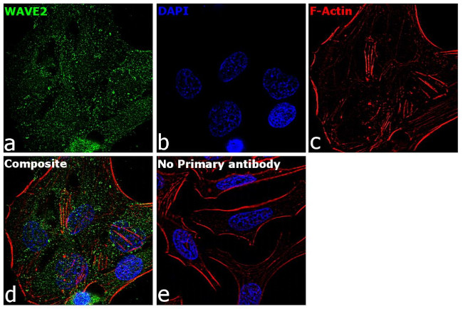 WAVE2 Antibody in Immunocytochemistry (ICC/IF)