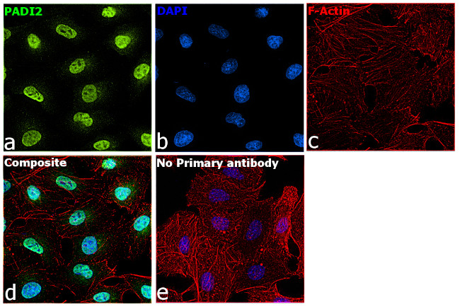 PADI2 Antibody in Immunocytochemistry (ICC/IF)