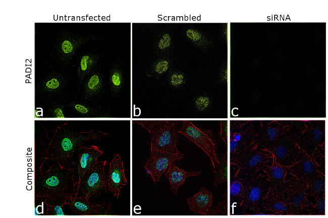 PADI2 Antibody in Immunocytochemistry (ICC/IF)