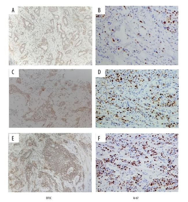 eIF3c Antibody in Immunohistochemistry (IHC)