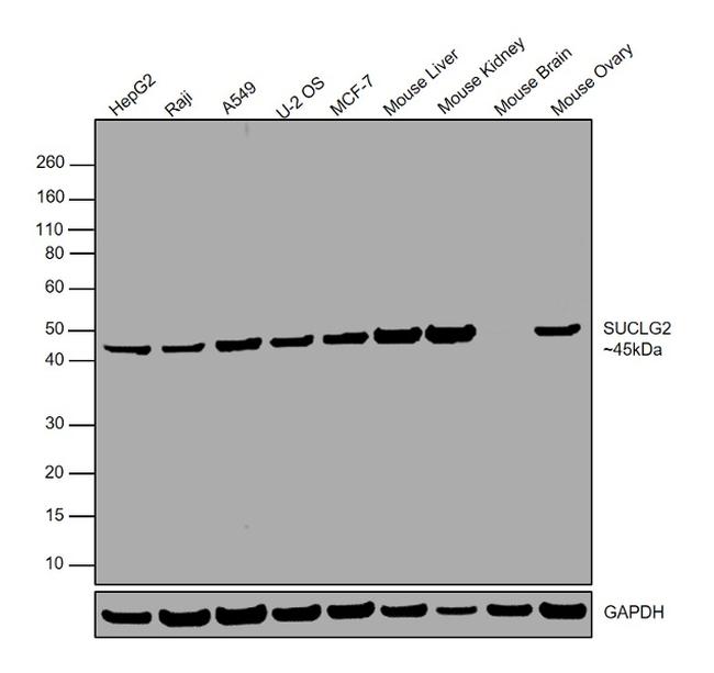 SUCLG2 Antibody in Western Blot (WB)