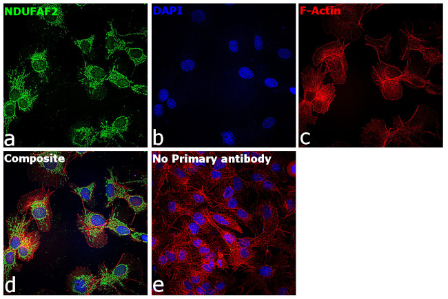 NDUFAF2 Antibody in Immunocytochemistry (ICC/IF)