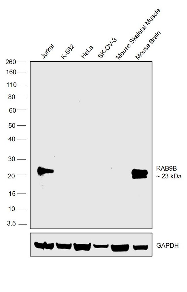 RAB9B Antibody in Western Blot (WB)