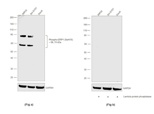 Phospho-DRP1 (Ser616) Antibody