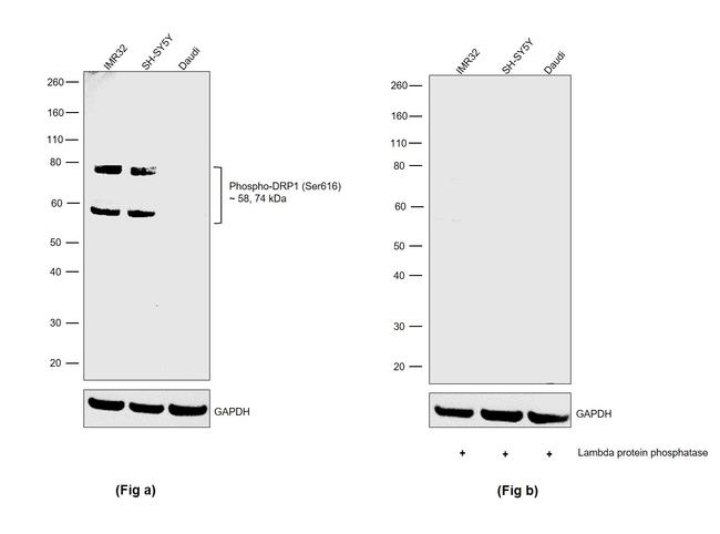 Phospho-DRP1 (Ser616) Antibody in Western Blot (WB)