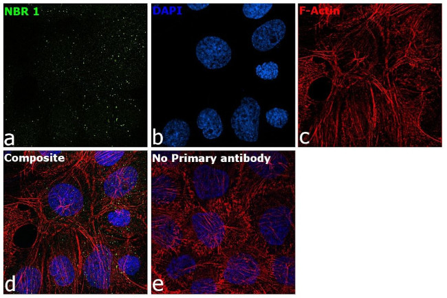 NBR1 Antibody in Immunocytochemistry (ICC/IF)