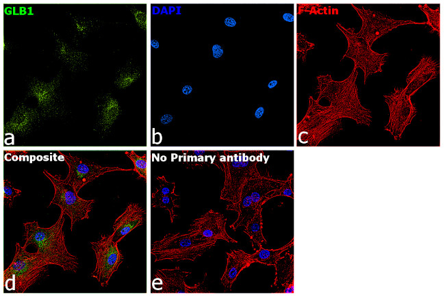 GLB1 Antibody in Immunocytochemistry (ICC/IF)