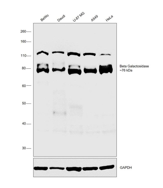 GLB1 Antibody in Western Blot (WB)