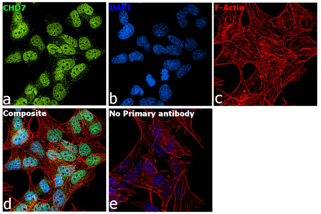 CHD7 Antibody in Immunocytochemistry (ICC/IF)