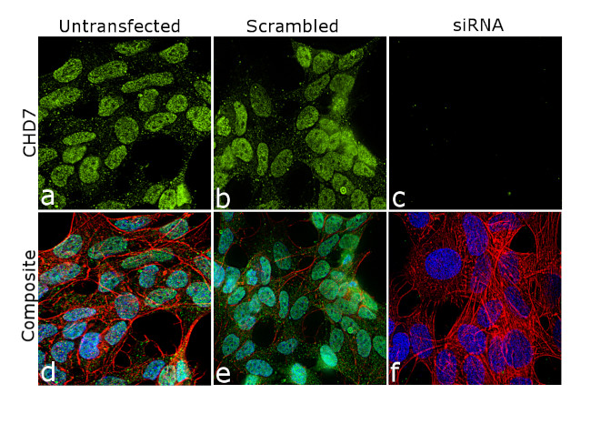 CHD7 Antibody in Immunocytochemistry (ICC/IF)