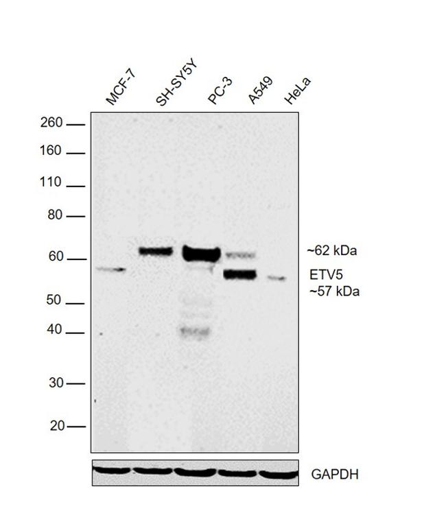 ETV5 Antibody in Western Blot (WB)