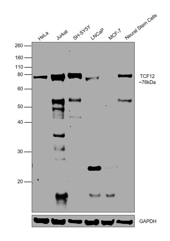 TCF12 Antibody in Western Blot (WB)