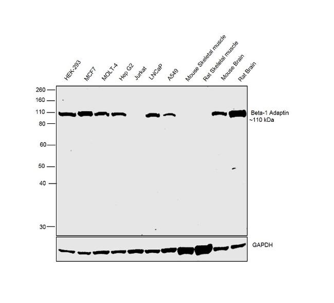 beta-1 Adaptin Antibody in Western Blot (WB)