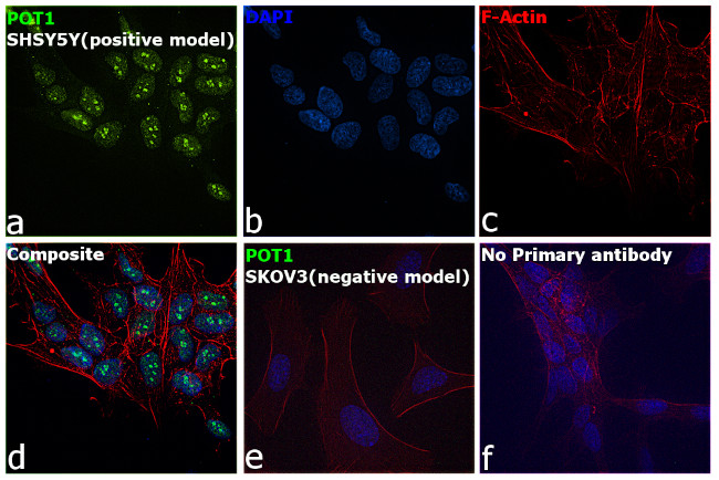 POT1 Antibody in Immunocytochemistry (ICC/IF)