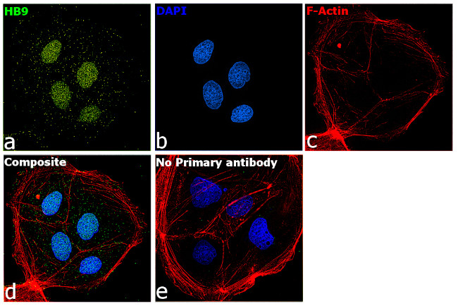 HB9 Antibody in Immunocytochemistry (ICC/IF)