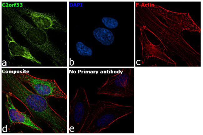 C2orf33 Antibody in Immunocytochemistry (ICC/IF)