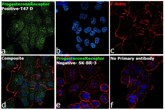 Progesterone Receptor Antibody