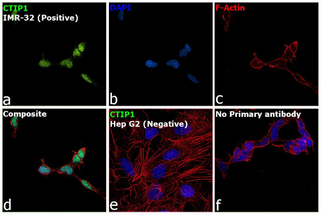 BCL11A Antibody