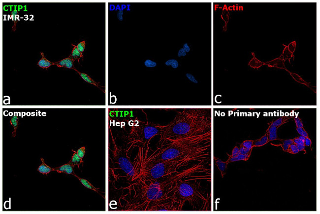 BCL11A Antibody in Immunocytochemistry (ICC/IF)