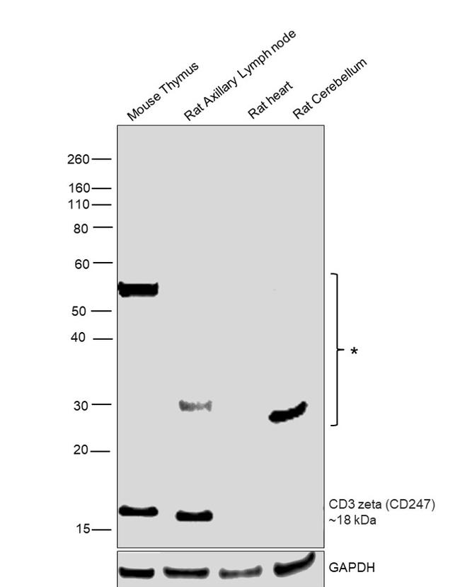 CD3 zeta (CD247) Antibody in Western Blot (WB)