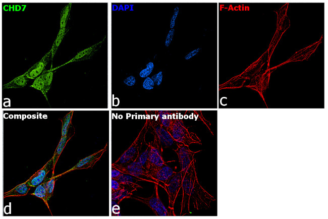 CHD7 Antibody in Immunocytochemistry (ICC/IF)