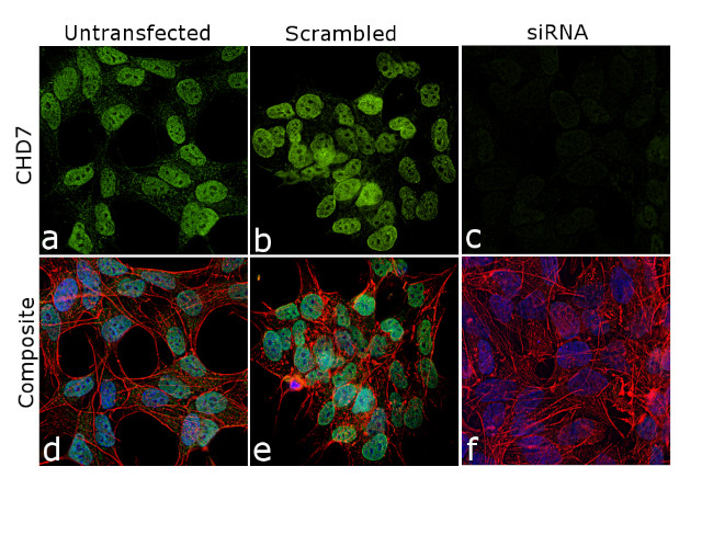 CHD7 Antibody in Immunocytochemistry (ICC/IF)