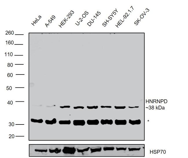 hnRNP D Antibody in Western Blot (WB)