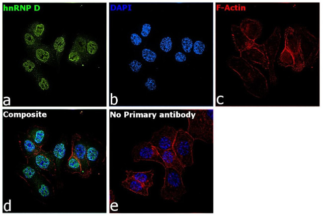 hnRNP D Antibody in Immunocytochemistry (ICC/IF)