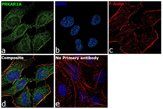 PRKAR1A Antibody in Immunocytochemistry (ICC/IF)