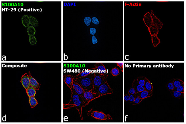 S100A10 Antibody