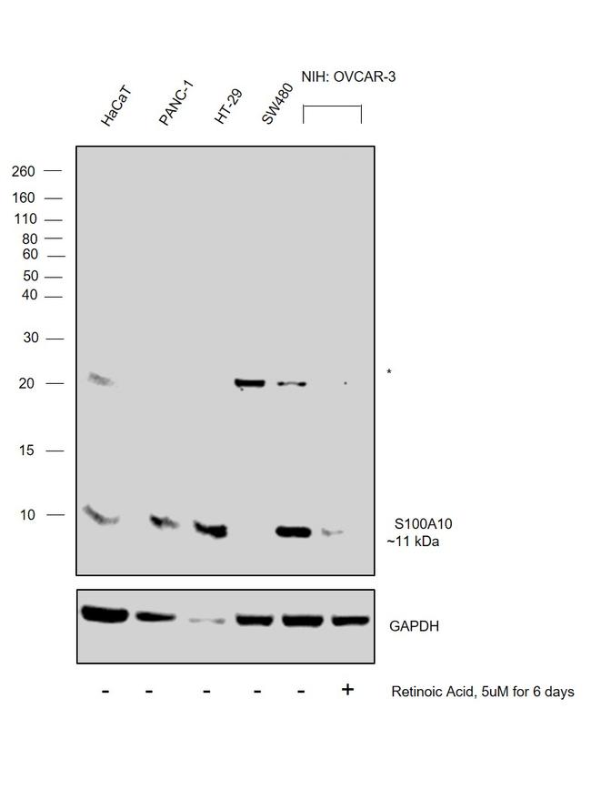 S100A10 Antibody in Western Blot (WB)