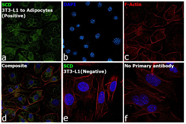 SCD Antibody