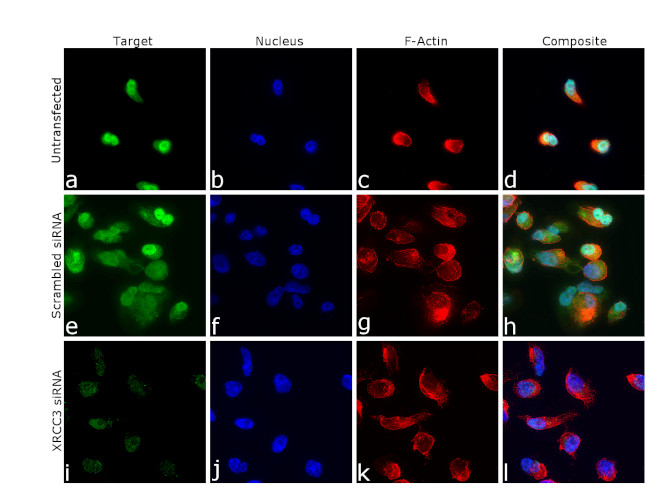 XRCC3 Antibody in Immunocytochemistry (ICC/IF)