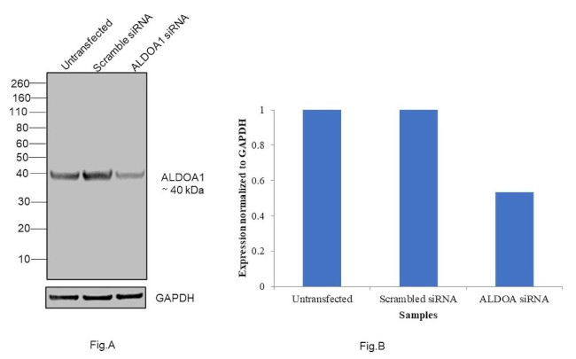 Aldolase A Antibody