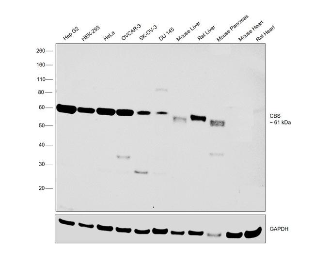 CBS Antibody in Western Blot (WB)